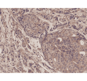 Immunohistochemistry - Anti-NF-kB p65 Antibody [RM273] (A121413) - Antibodies.com