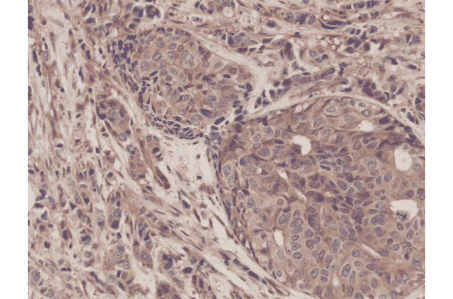 Immunohistochemistry - Anti-NF-kB p65 Antibody [RM273] (A121413) - Antibodies.com