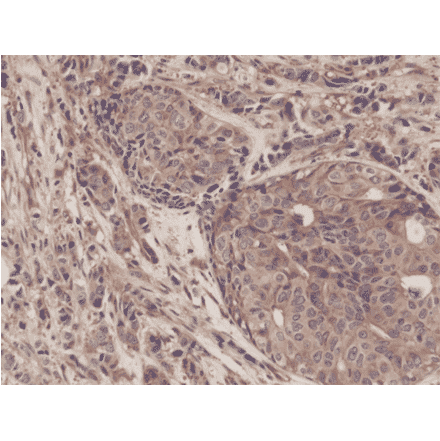 Immunohistochemistry - Anti-NF-kB p65 Antibody [RM273] (A121413) - Antibodies.com