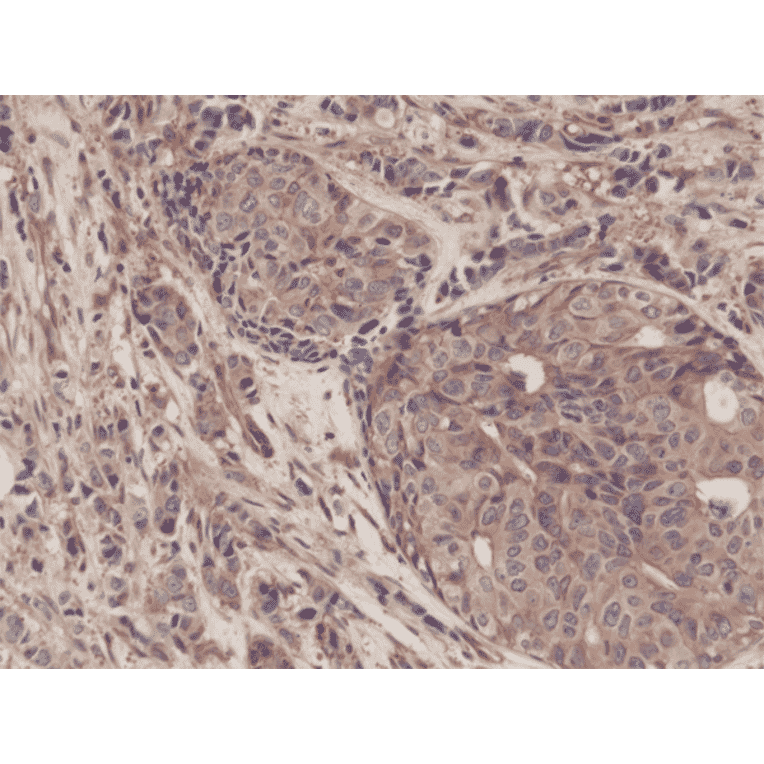 Immunohistochemistry - Anti-NF-kB p65 Antibody [RM273] (A121413) - Antibodies.com
