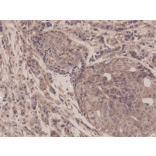 Immunohistochemistry - Anti-NF-kB p65 Antibody [RM273] (A121413) - Antibodies.com