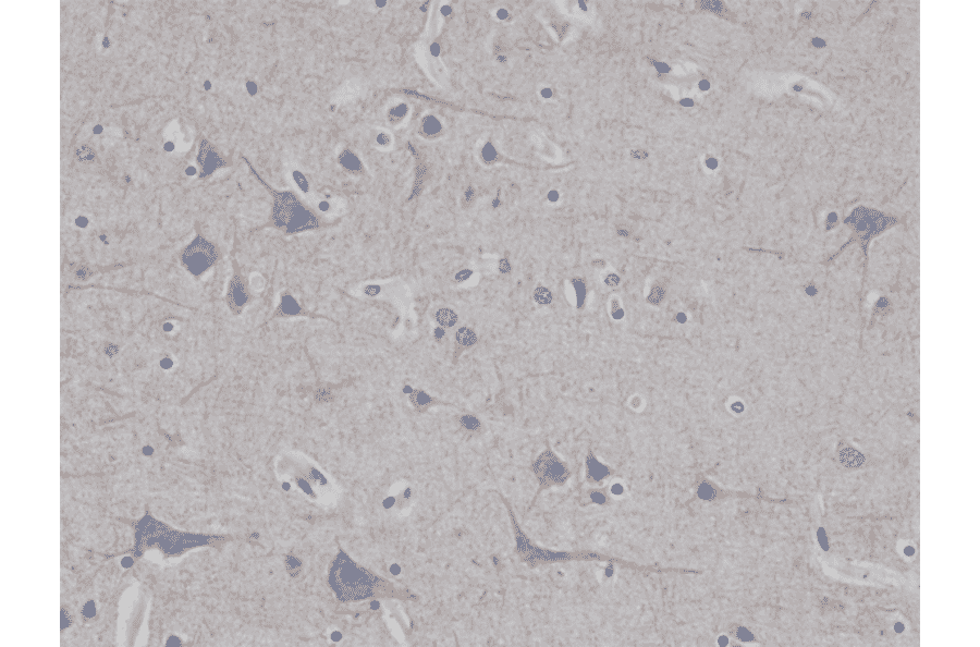 Immunohistochemistry - Anti-68kDa Neurofilament Antibody [RM280] (A121471) - Antibodies.com