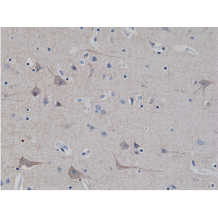 Immunohistochemistry - Anti-68kDa Neurofilament Antibody [RM280] (A121471) - Antibodies.com