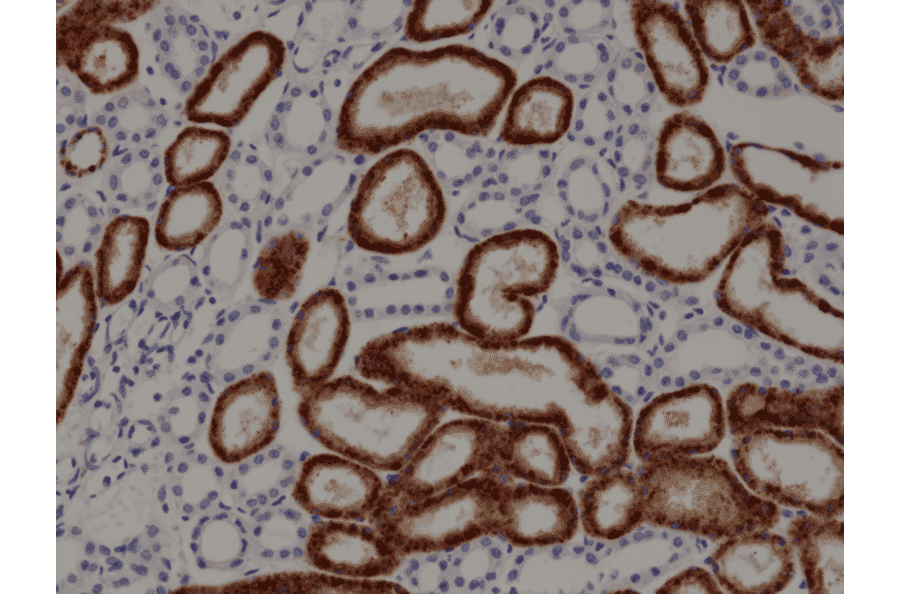Immunohistochemistry - Anti-NAPSIN A Antibody [RM366] (A121460) - Antibodies.com
