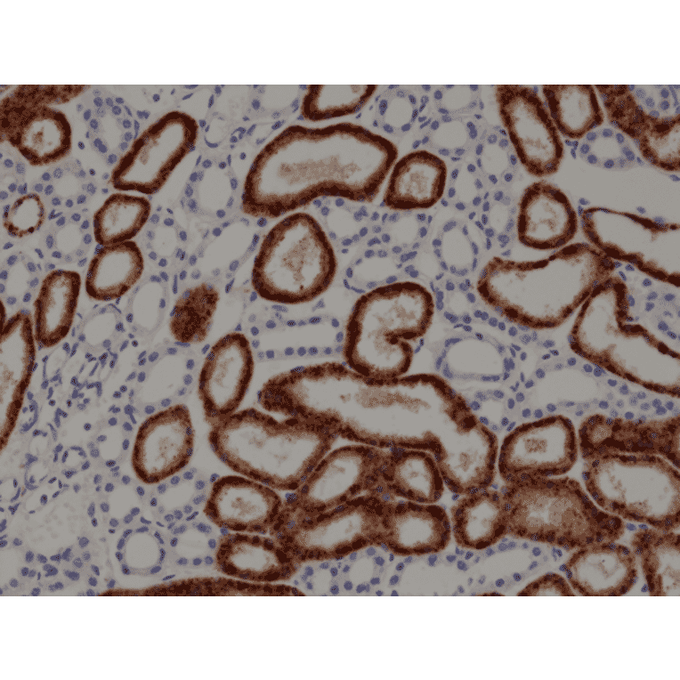 Immunohistochemistry - Anti-NAPSIN A Antibody [RM366] (A121460) - Antibodies.com