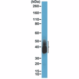 Western Blot - Anti-NAPSIN A Antibody [RM366] (A121450) - Antibodies.com