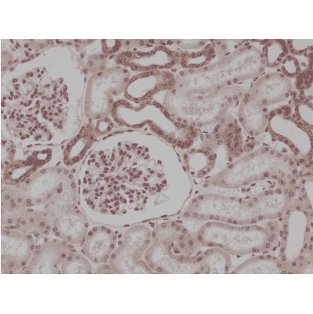 Immunohistochemistry - Anti-MyD88 Antibody [RM306] (A121320) - Antibodies.com