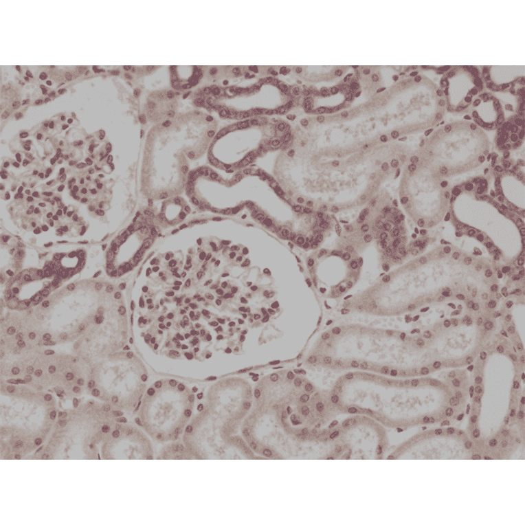Immunohistochemistry - Anti-MyD88 Antibody [RM306] (A121320) - Antibodies.com
