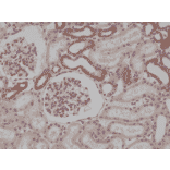 Immunohistochemistry - Anti-MyD88 Antibody [RM306] (A121320) - Antibodies.com