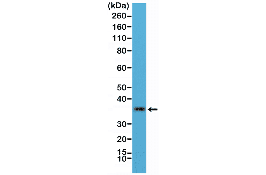 Western Blot - Anti-MyD88 Antibody [RM306] (A121451) - Antibodies.com