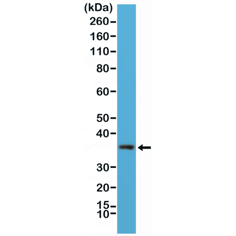 Western Blot - Anti-MyD88 Antibody [RM306] (A121451) - Antibodies.com