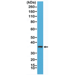 Western Blot - Anti-MyD88 Antibody [RM306] (A121451) - Antibodies.com