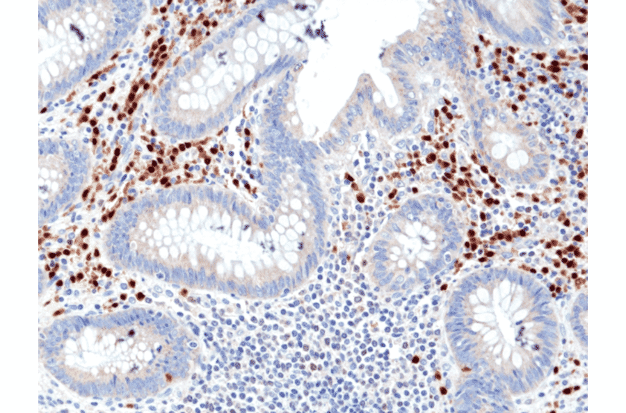 Immunohistochemistry - Anti-MUM1 Antibody [RM352] (A121472) - Antibodies.com