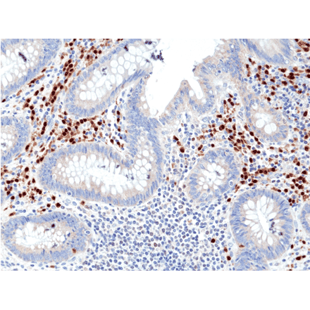 Immunohistochemistry - Anti-MUM1 Antibody [RM352] (A121472) - Antibodies.com