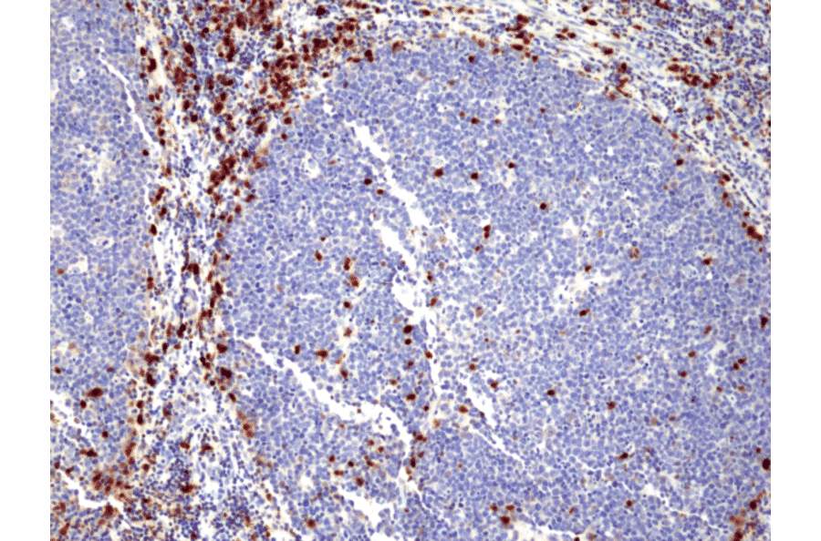 Immunohistochemistry - Anti-MUM1 Antibody [RM352] (A121452) - Antibodies.com