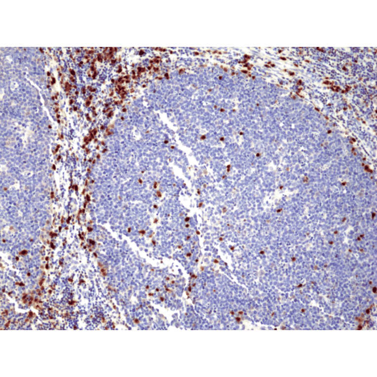 Immunohistochemistry - Anti-MUM1 Antibody [RM352] (A121452) - Antibodies.com