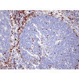 Immunohistochemistry - Anti-MUM1 Antibody [RM352] (A121452) - Antibodies.com