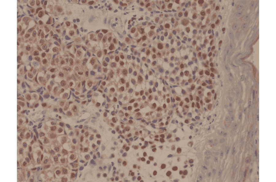 Immunohistochemistry - Anti-MUM1 Antibody [RM352] (A121452) - Antibodies.com