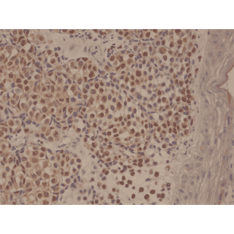Immunohistochemistry - Anti-MUM1 Antibody [RM352] (A121452) - Antibodies.com