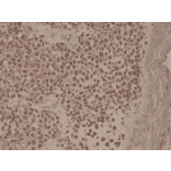Immunohistochemistry - Anti-MUM1 Antibody [RM352] (A121452) - Antibodies.com
