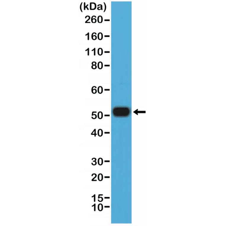 Western Blot - Anti-MUM1 Antibody [RM352] (A121452) - Antibodies.com