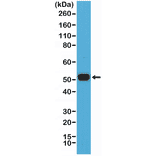 Western Blot - Anti-MUM1 Antibody [RM352] (A121452) - Antibodies.com