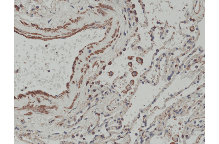 Immunohistochemistry - Anti-MMP12 Antibody [RM381] (A121458) - Antibodies.com