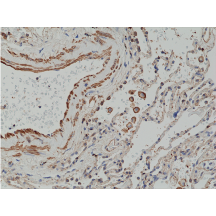 Immunohistochemistry - Anti-MMP12 Antibody [RM381] (A121458) - Antibodies.com