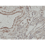 Immunohistochemistry - Anti-MMP12 Antibody [RM381] (A121458) - Antibodies.com