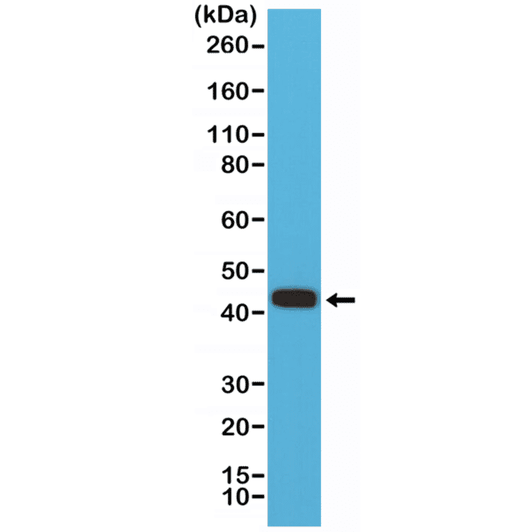 Western Blot - Anti-MMP12 Antibody [RM381] (A121453) - Antibodies.com