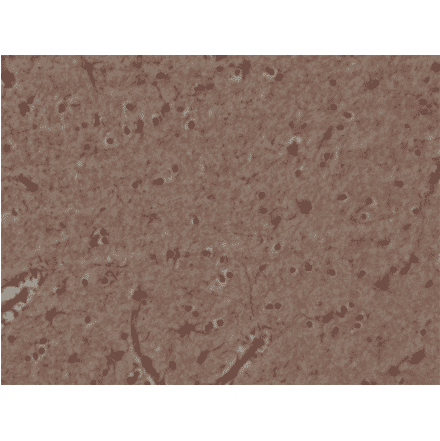 Immunohistochemistry - Anti-Glutathione S Transferase pi Antibody [RM347] (A121435) - Antibodies.com