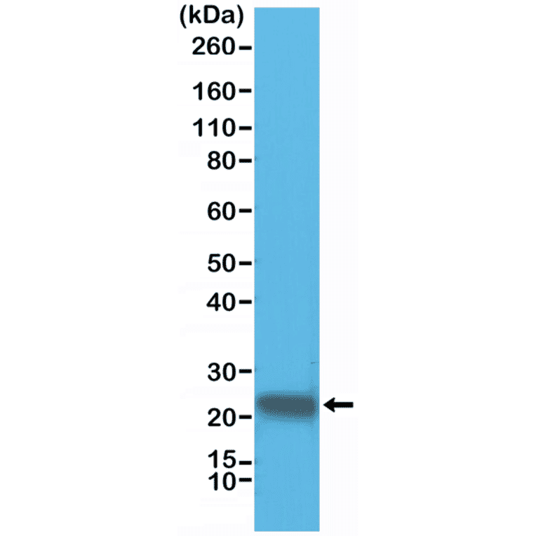 glutathione s-transferase-pi antibody Anti-Glutathione S Transferase pi [RM347] (A121456) Electrolyte Flavour:Raspberry Pink Lemonade Dr James Glutathione Skin Acne Marks