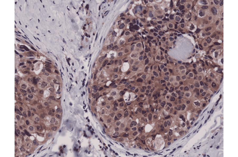 Immunohistochemistry - Anti-Caspase 3 Antibody [RM250] (A121391) - Antibodies.com