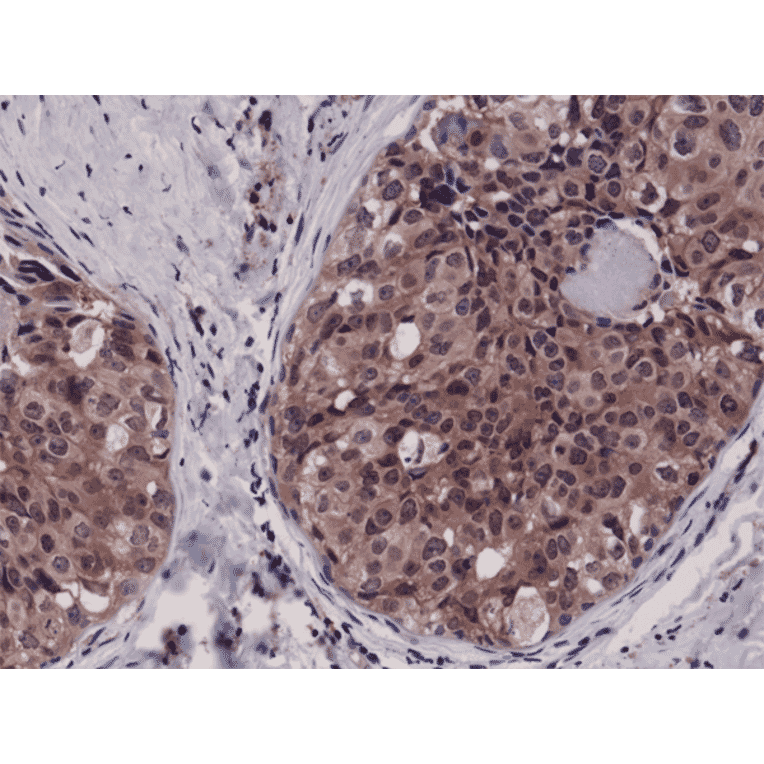 Immunohistochemistry - Anti-Caspase 3 Antibody [RM250] (A121391) - Antibodies.com