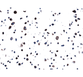 Immunohistochemistry - Anti-EGFR Antibody [RM380] (A121458) - Antibodies.com