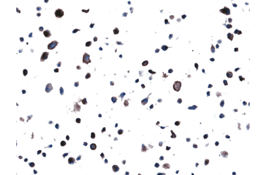 Immunohistochemistry - Anti-EGFR Antibody [RM380] (A121458) - Antibodies.com