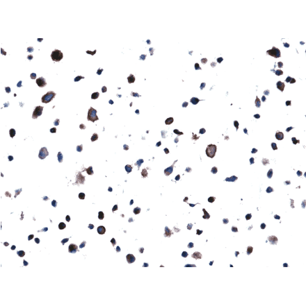 Immunohistochemistry - Anti-EGFR Antibody [RM380] (A121458) - Antibodies.com