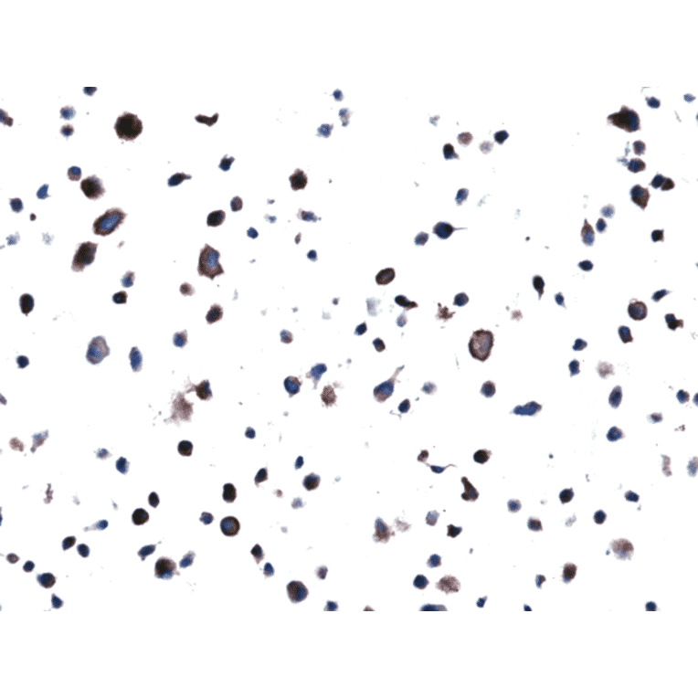 Immunohistochemistry - Anti-EGFR Antibody [RM380] (A121458) - Antibodies.com