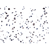 Immunohistochemistry - Anti-EGFR Antibody [RM380] (A121458) - Antibodies.com
