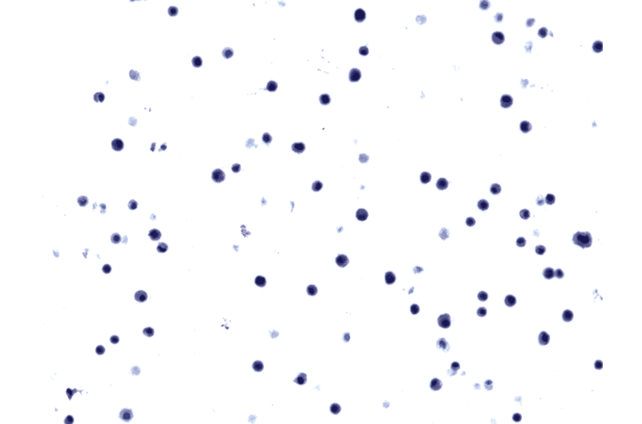 Immunohistochemistry - Anti-EGFR Antibody [RM380] (A121432) - Antibodies.com