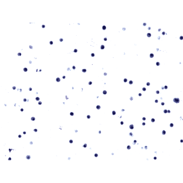 Immunohistochemistry - Anti-EGFR Antibody [RM380] (A121432) - Antibodies.com