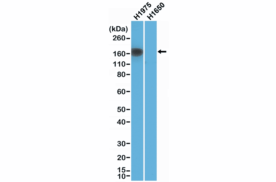 Western Blot - Anti-EGFR Antibody [RM380] (A121458) - Antibodies.com