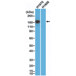Western Blot - Anti-EGFR Antibody [RM380] (A121458) - Antibodies.com
