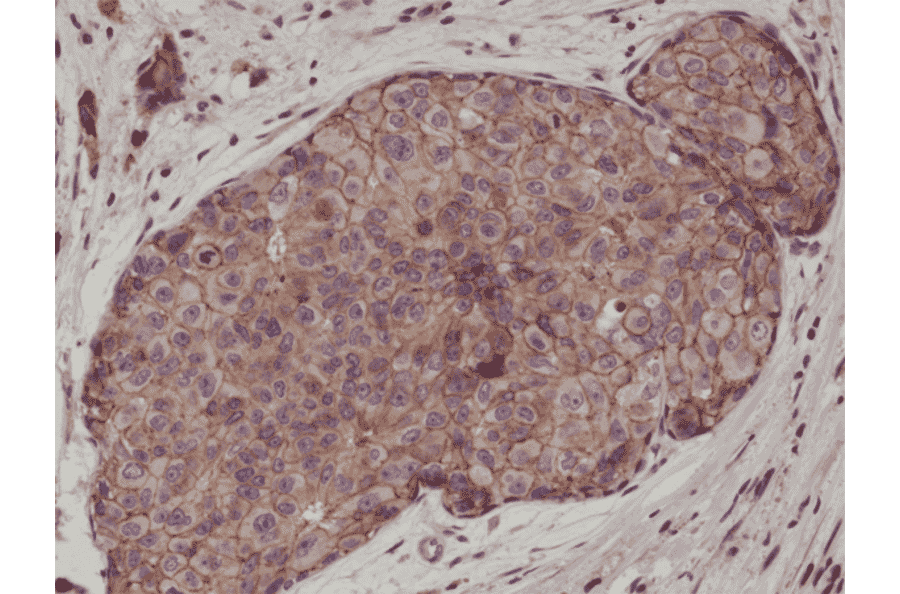 Immunohistochemistry - Anti-E Cadherin Antibody [RM244] (A121397) - Antibodies.com