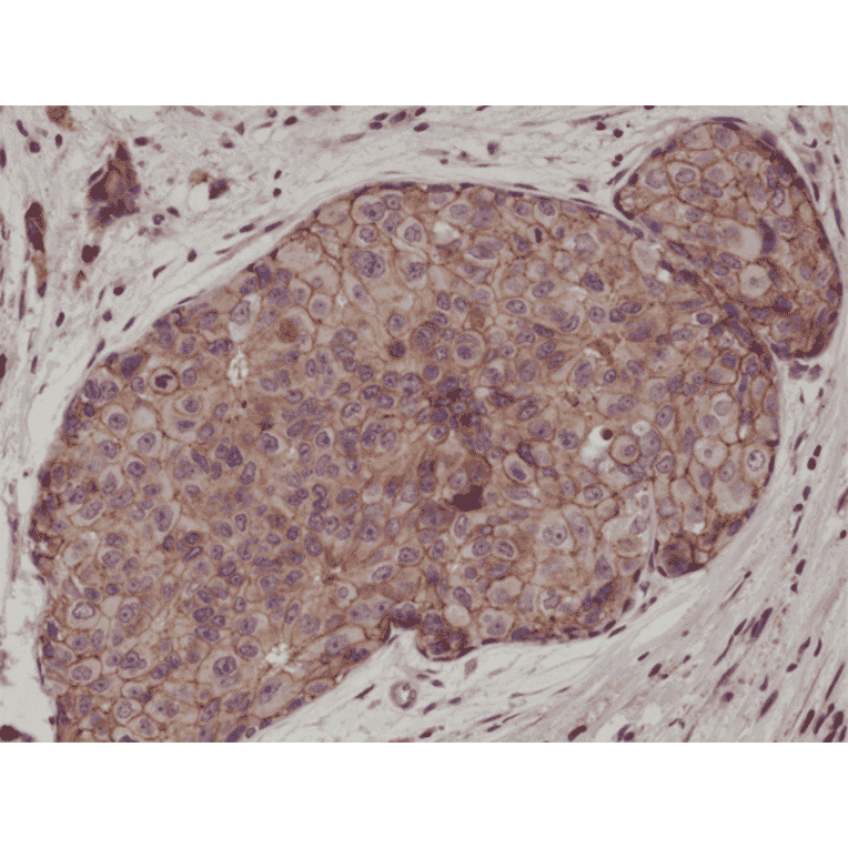 Immunohistochemistry - Anti-E Cadherin Antibody [RM244] (A121397) - Antibodies.com