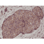 Immunohistochemistry - Anti-E Cadherin Antibody [RM244] (A121397) - Antibodies.com