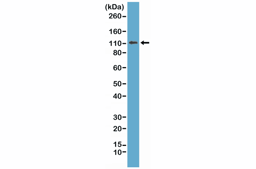 Western Blot - Anti-E Cadherin Antibody [RM244] (A121459) - Antibodies.com