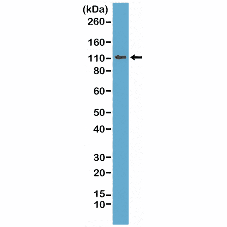 Western Blot - Anti-E Cadherin Antibody [RM244] (A121459) - Antibodies.com