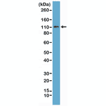 Western Blot - Anti-E Cadherin Antibody [RM244] (A121459) - Antibodies.com