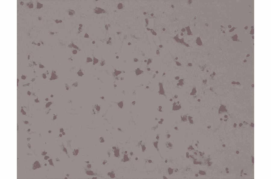 Immunohistochemistry - Anti-SATB2 Antibody [RM365] (A121296) - Antibodies.com